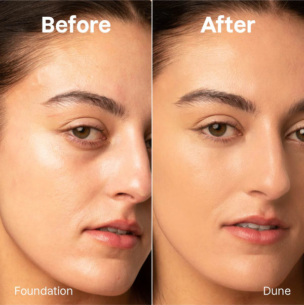 Foundation